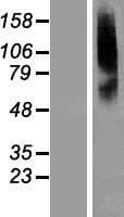 Human SLC22A8 / OAT3 Protein (Over-Expression Lysate Myc-DDK (Flag))