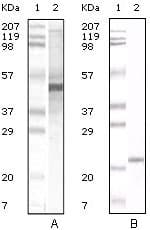 Monoclonal Mouse anti-Human Apolipoprotein A-V Antibody (clone 2G1H11, IHC, IF, WB)