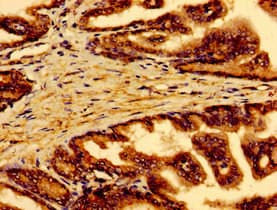 RAB5A / RAB5 Antibody