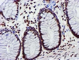 GSTT2 Antibody (clone OTI3B6)
