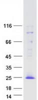 Human TOMM20L Protein (Recombinant Myc-DDK (Flag))