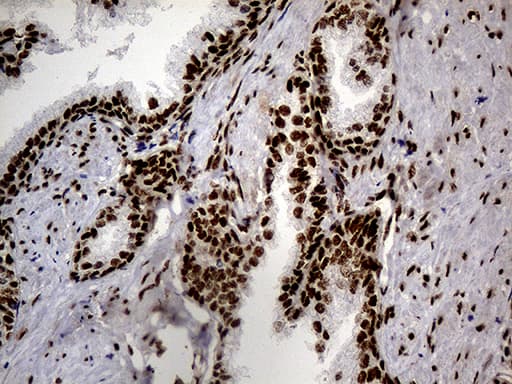 Monoclonal Mouse anti-Human HNRNPH1 / hnRNP H Antibody (clone OTI1H3, Carrier-free, IHC, WB)