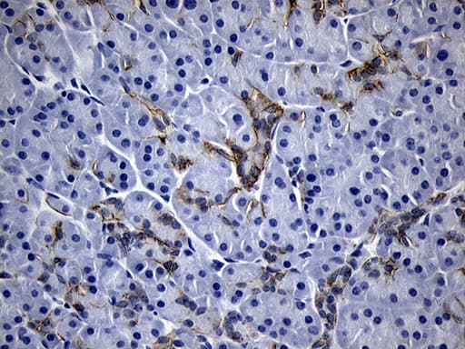 Monoclonal Mouse anti-Human ROR2 Antibody (clone OTI2G1, Carrier-free, aa796-927, IHC, WB)