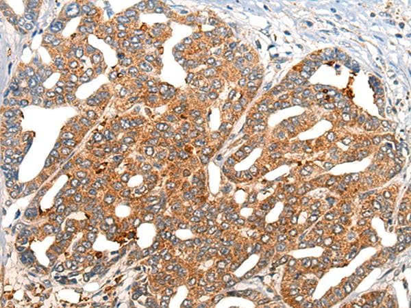 NOG / Noggin Antibody