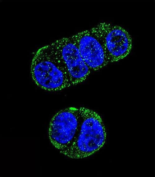 FOLH1 / PSMA Antibody (aa161-190)