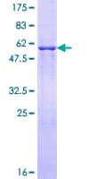 Human FVT1 / KDSR Protein (Recombinant GST)