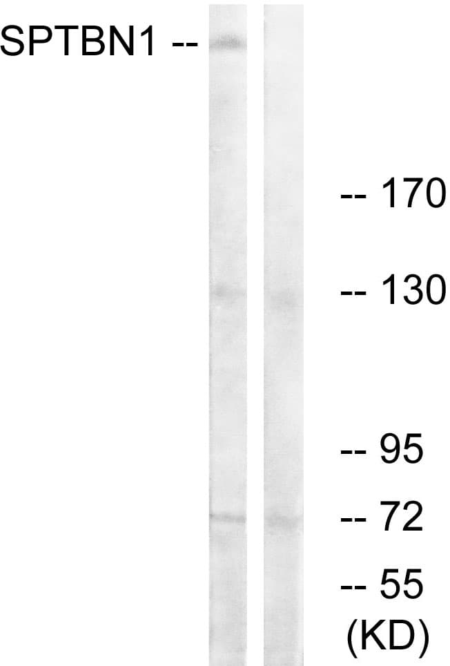SPTBN1 / ELF Antibody (aa651-700)