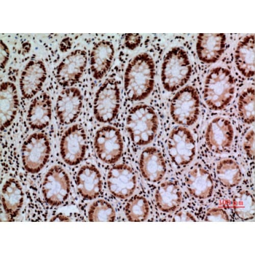 Polyclonal Rabbit anti-Human CACYBP Antibody (161-210 aa, C-terminal, IHC, WB)