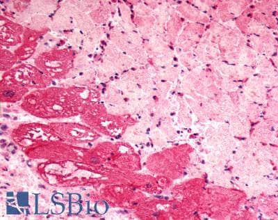 PathPlus™ Polyclonal Rabbit anti-Human BDKRB2/Bradykinin B2 Receptor Antibody (C-Terminus, IHC)