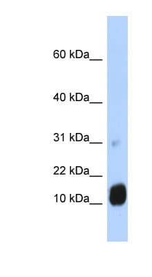Polyclonal Rabbit anti-Human GCHFR Antibody (N-Terminus, WB)