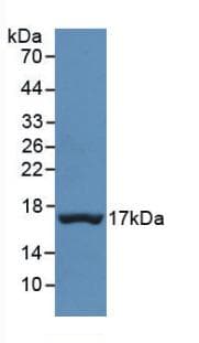 TTR / Transthyretin Antibody (aa21-147)