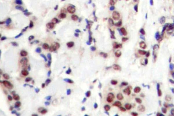 Polyclonal Rabbit anti-Human STAT5 A+B Antibody (phospho-Tyr694, IHC, WB)