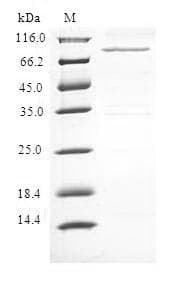 Human MLLT3 / AF9 Protein (Recombinant 6His-B2M, N-terminus)