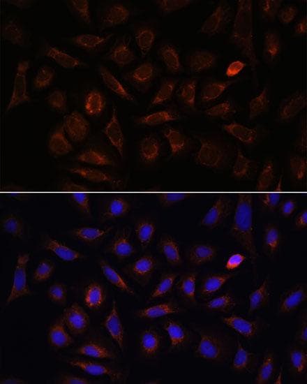 NRP1 / Neuropilin 1 Antibody