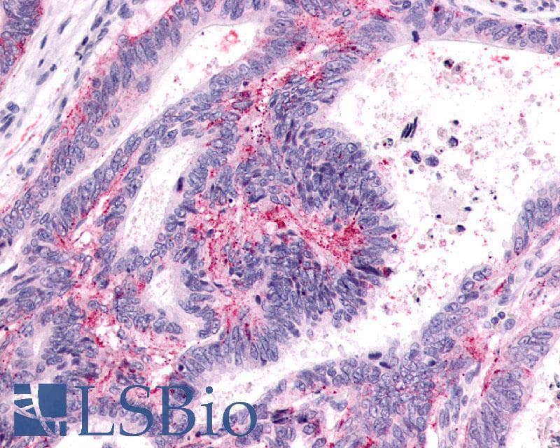IHC-plus™ Polyclonal Rabbit anti-Human PTGER3 / EP3 Antibody (Cytoplasmic Domain, IHC)