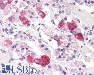 PathPlus™ BRS3 Antibody (C-Terminus)