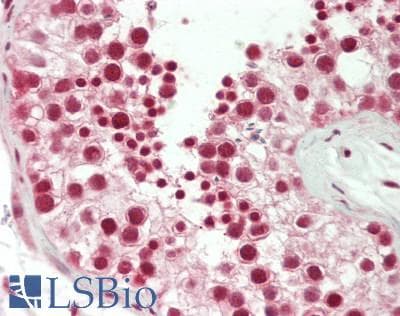 IHC-plus™ LMX1B Antibody (100-180 aa, Internal)