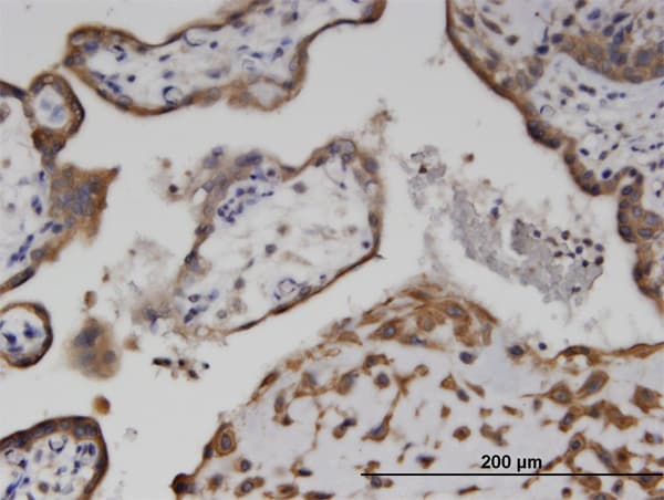Monoclonal Mouse anti-Human AK9 / AKD1 / AKD2 Antibody (clone 1H8, IHC)