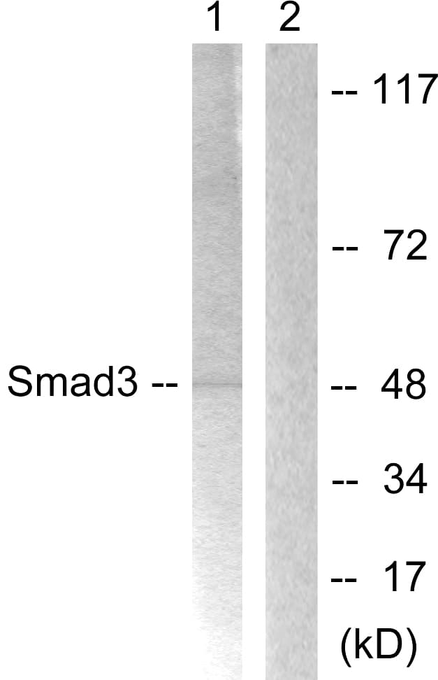 Polyclonal Rabbit anti-Human SMAD3 Antibody (aa179-228, WB)