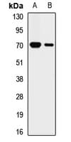 KRT2 / CK2 / Cytokeratin 2 Antibody