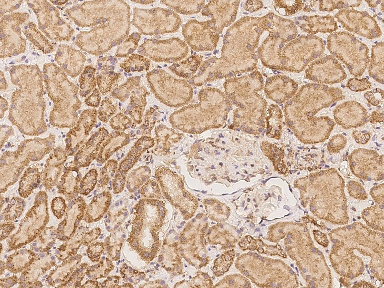 ROBO3 Antibody