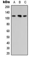 ARHGAP30 Antibody (Internal)