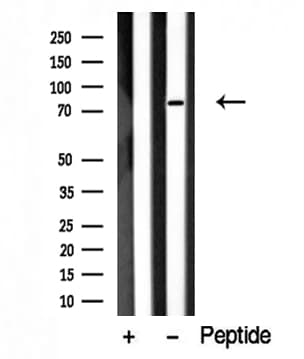 PTK6 / BRK Antibody