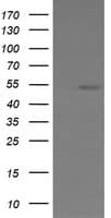 ERG Antibody (clone OTI6A4)