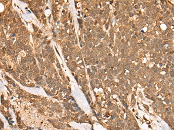 CAPN15 / SOLH Antibody