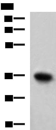 Polyclonal Rabbit anti-Human TNNT1 / TNT Antibody (IHC, WB)