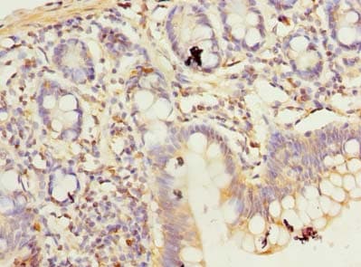 C10orf62 Antibody