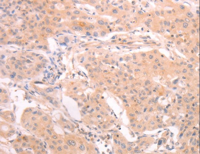 INA / Alpha Internexin Antibody