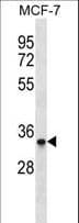 CMT2 / MAD2L1BP Antibody (aa1-30)