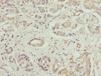 FCGRT / FCRN Antibody