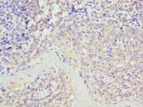 STK16 Antibody (aa1-305)