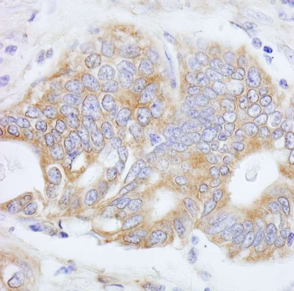 PTP-PEST / PTPN12 Antibody (aa500-550)