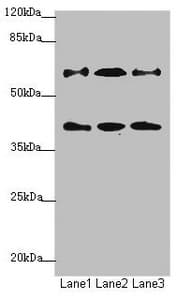 SMIF / DCP1A Antibody