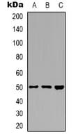 ZFYVE19 Antibody (Internal)