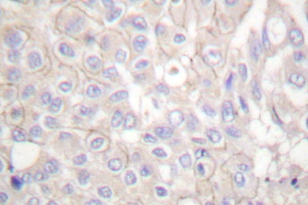 CDH1 / E Cadherin Antibody (Gly2)