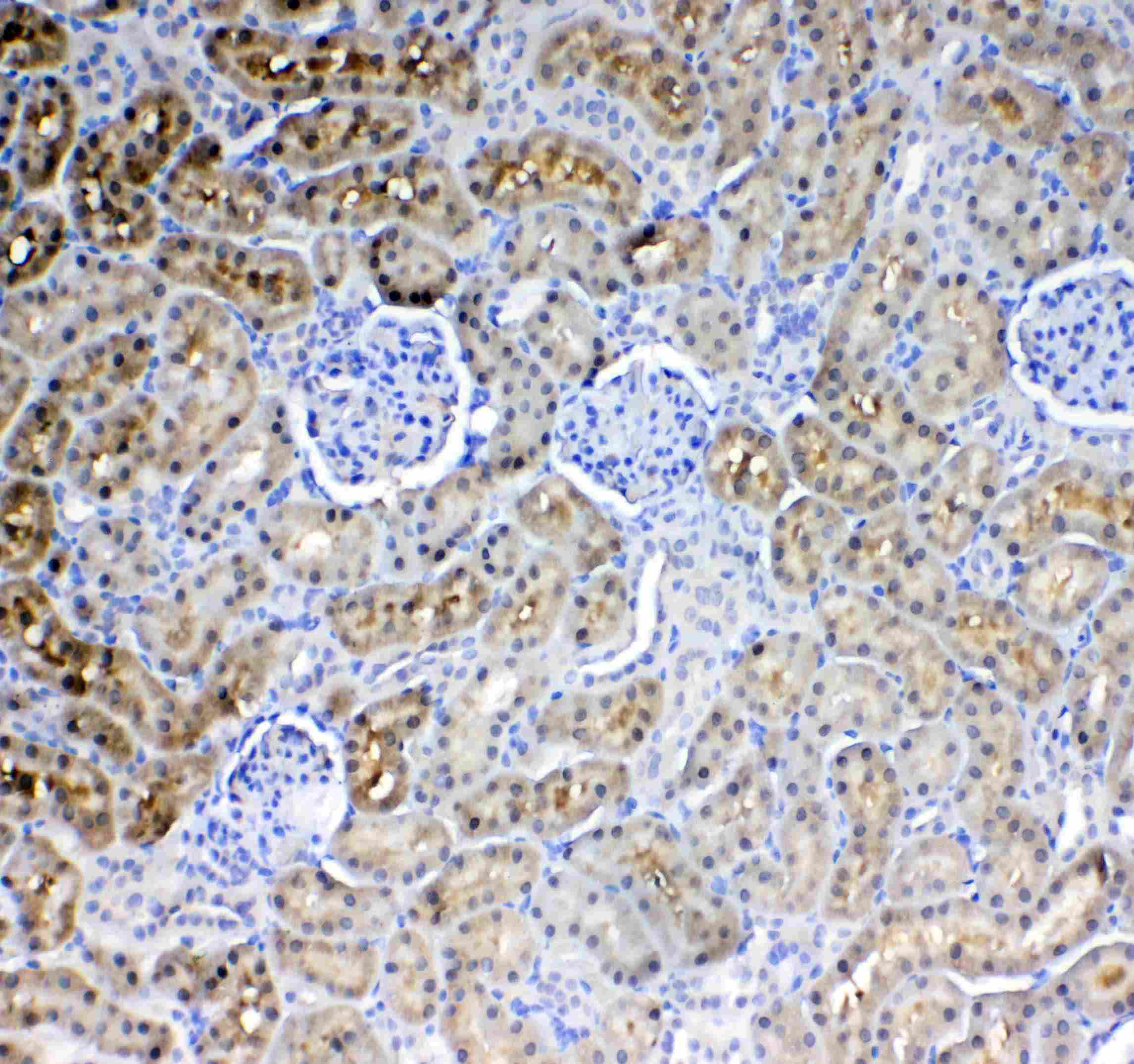 Polyclonal Rabbit anti-Human GK / Glycerol Kinase Antibody (IHC, WB)