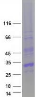 Human CITED1 Protein (Recombinant Myc-DDK (Flag))
