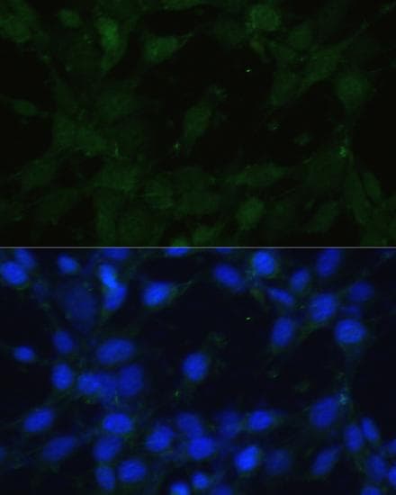 VR1 / TRPV1 Antibody