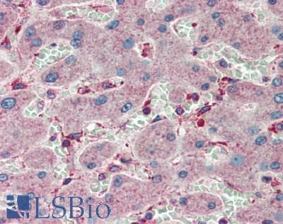 LPL / Lipoprotein Lipase Antibody (aa28-474)