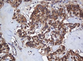 COG6 Antibody (clone OTI2D8)