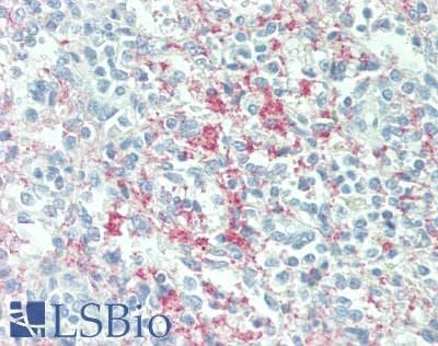 IHC-plus™ ITGB3 / Integrin Beta 3 / CD61 Antibody (clone Y2/51)