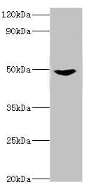 IHC-plus™ MAP2K5 / MEK5 Antibody (aa1-190)