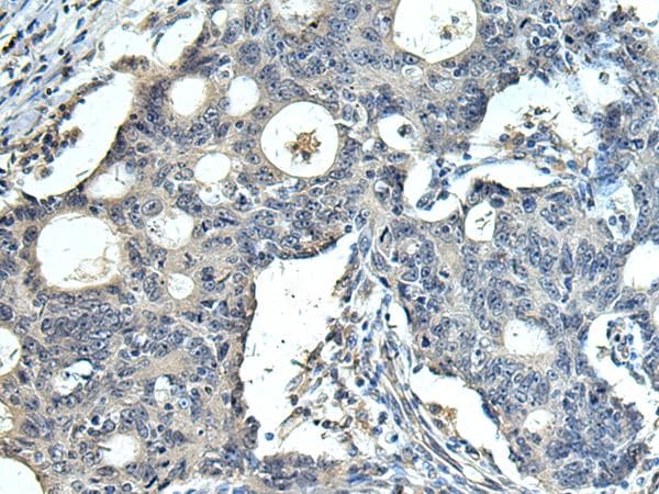 FCRLA Antibody