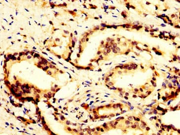 POLR3B Antibody