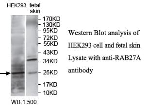 Polyclonal Rabbit anti-Human RAB27A / RAB27 Antibody (aa1-215, WB)