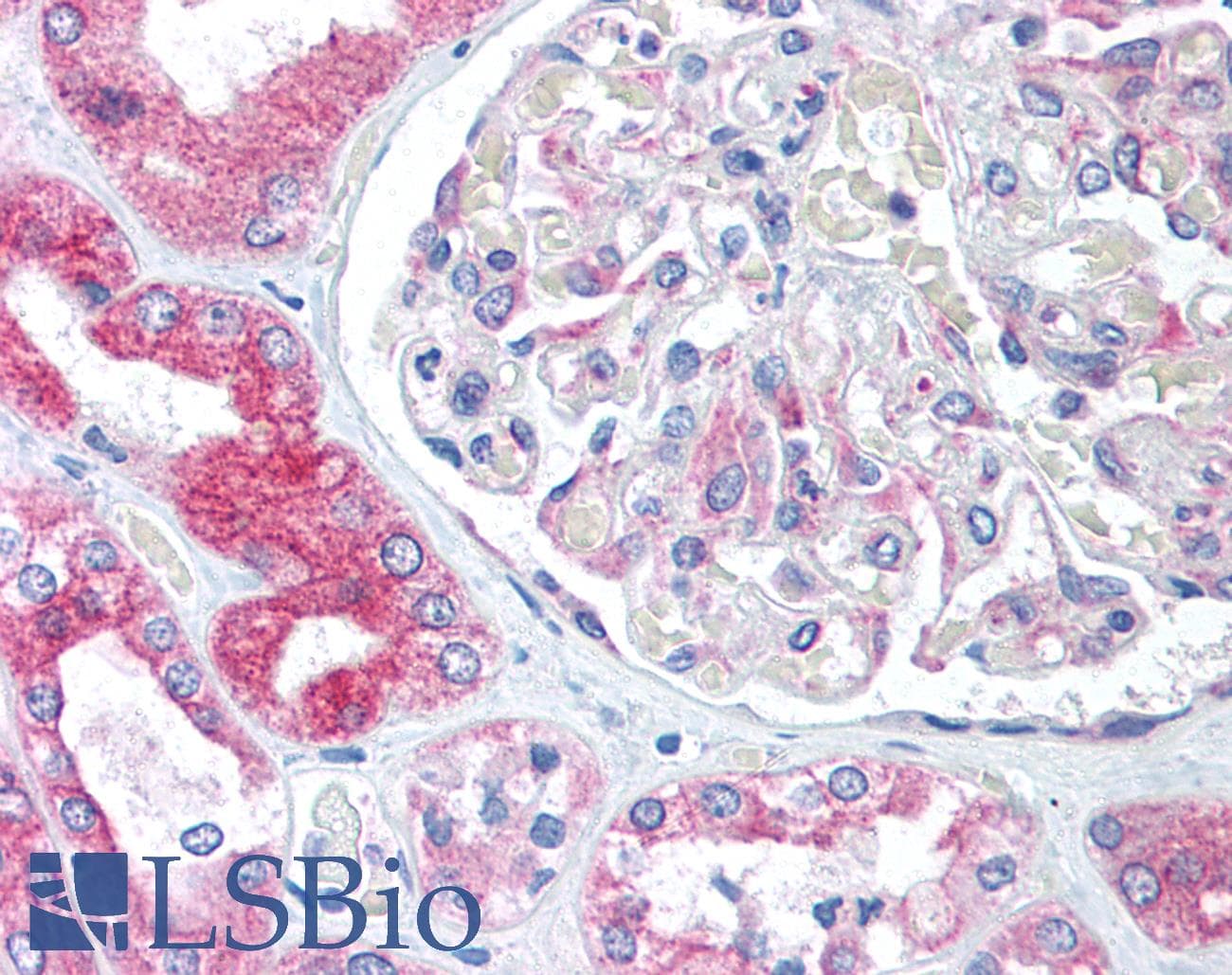 IHC-plus™ BCAP31 / BAP31 Antibody